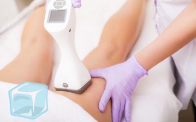 Incredible New Treatment Literally Freezes Off Unwanted Stubborn Cells