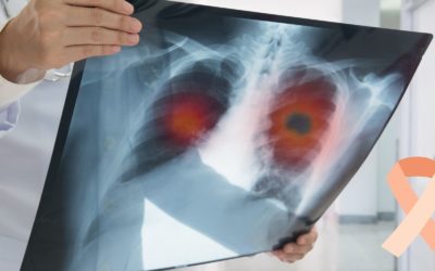 The Early Symptoms Of Lung Cancer You Can Not Miss (Vital!)