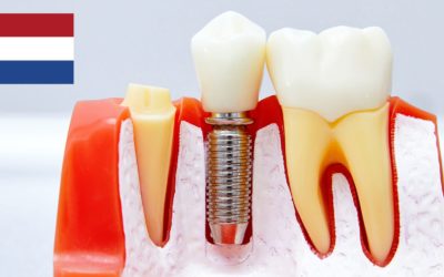 Waarom U In 2022 Te Veel Betaalt Voor Tandheelkundige Implantaten?