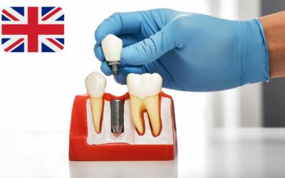 Why Brits Are Paying Too Much For Dental Implants in 2022